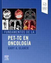 ULANER - FUNDAMENTOS DE LA PET-TC EN ONCOLOGÍA